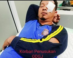 Pria ODGJ Ngamuk Saat Mandi Dan Lukai Pegawai Dinsos Muba.